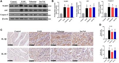 Sacubitril/Valsartan Alleviates Experimental Autoimmune Myocarditis by Inhibiting Th17 Cell Differentiation Independently of the NLRP3 Inflammasome Pathway